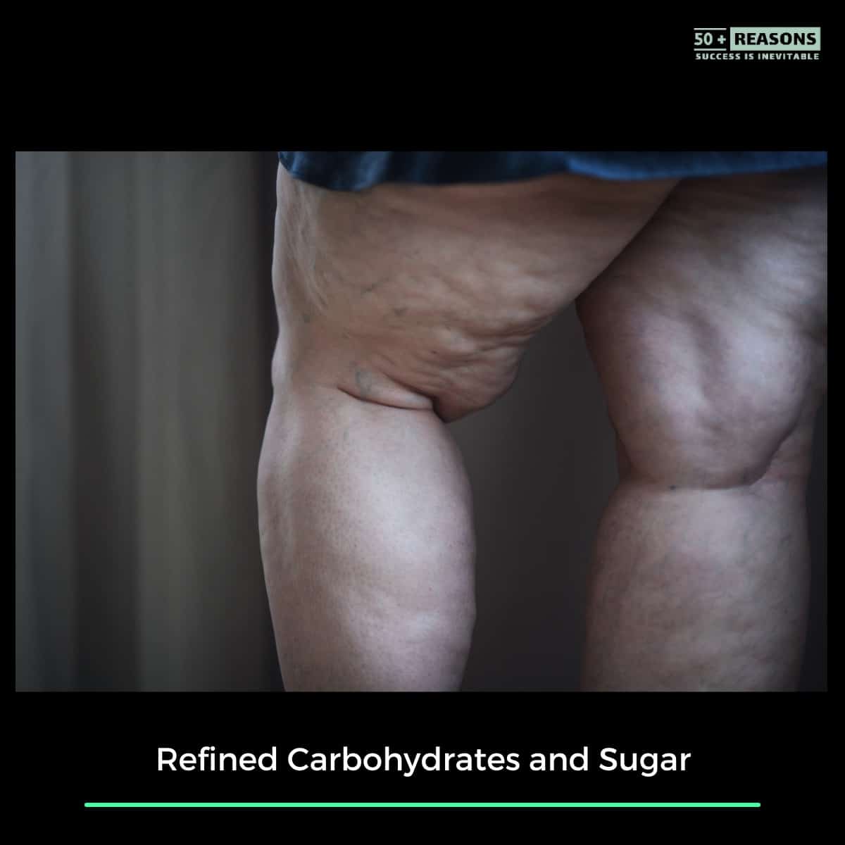 Refined Carbohydrates and Sugar